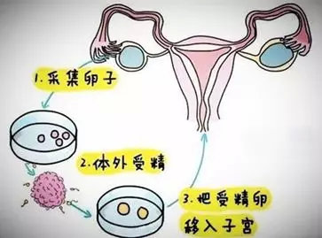 不孕不育与试管婴儿