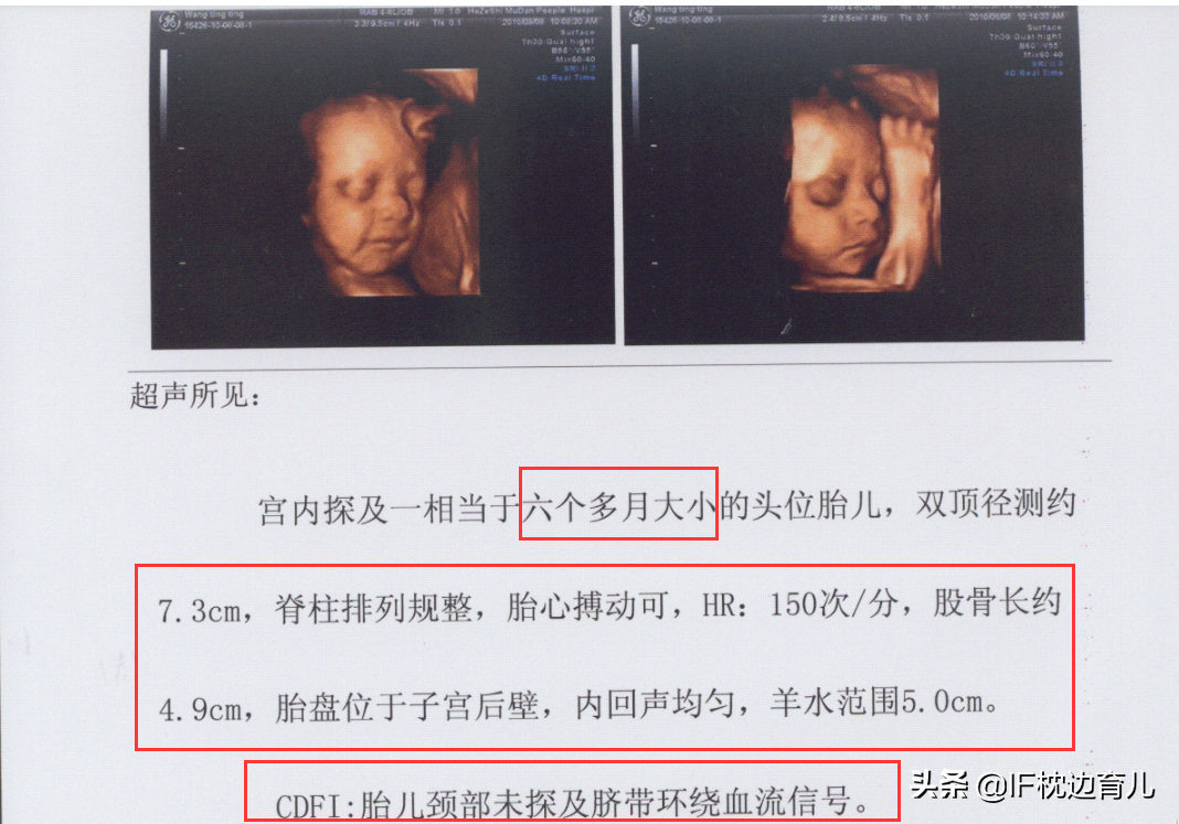 孕期这两个B超检查能不能省一回？医生：一次比一次重要，别错过