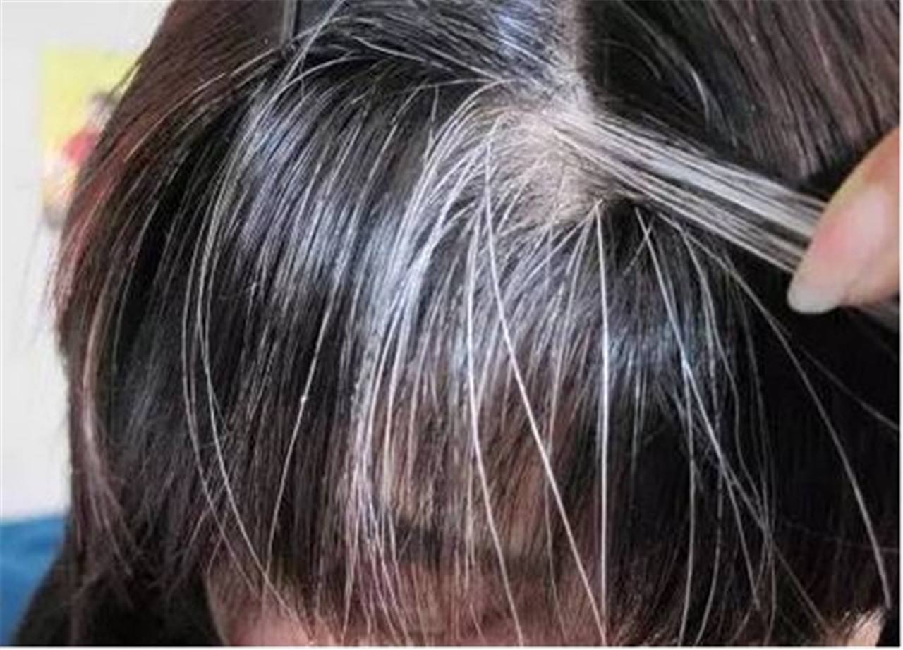 如今孩子早生华发的现象经常会吓坏父母,有人认为孩子压力大了,也有人