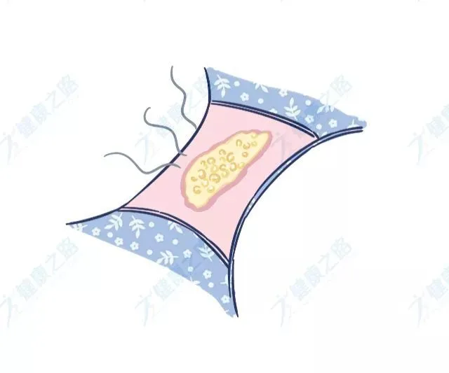 发黄、发臭、拉丝…出现6种白带异常，警惕阴道炎症