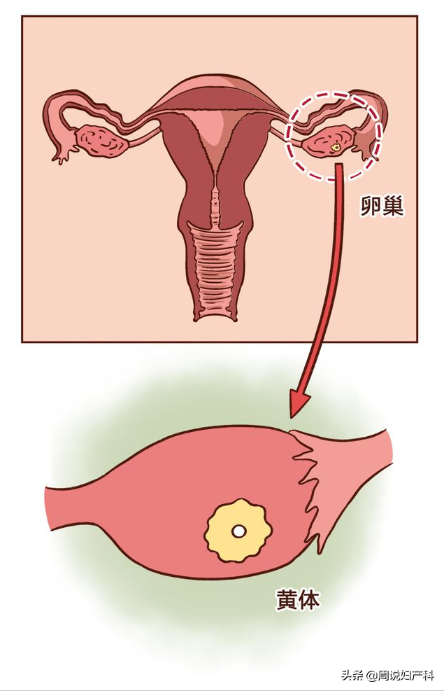 查出卵巢囊肿，会癌变吗？这2种情况治了就是瞎花钱