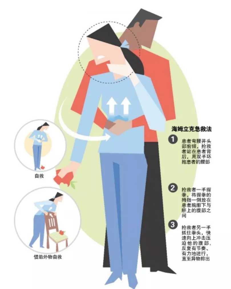 超实用!人人都该知道的6个家庭急救小常识,早看早受益