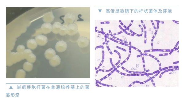 北京发现1例、山西发生皮肤炭疽疫情，炭疽可怕吗？会人传人吗？