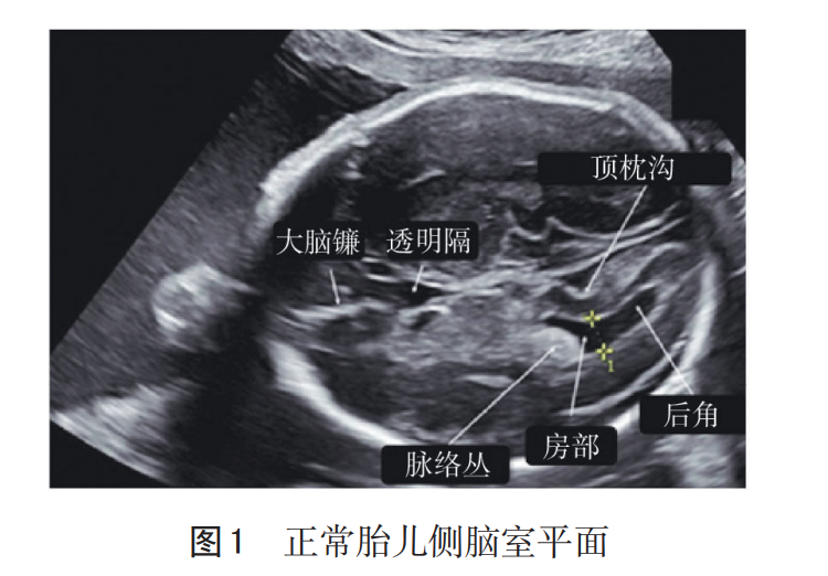 孕期做四维检查，了解这些指标，不用求医生，自己看胎儿是否健康