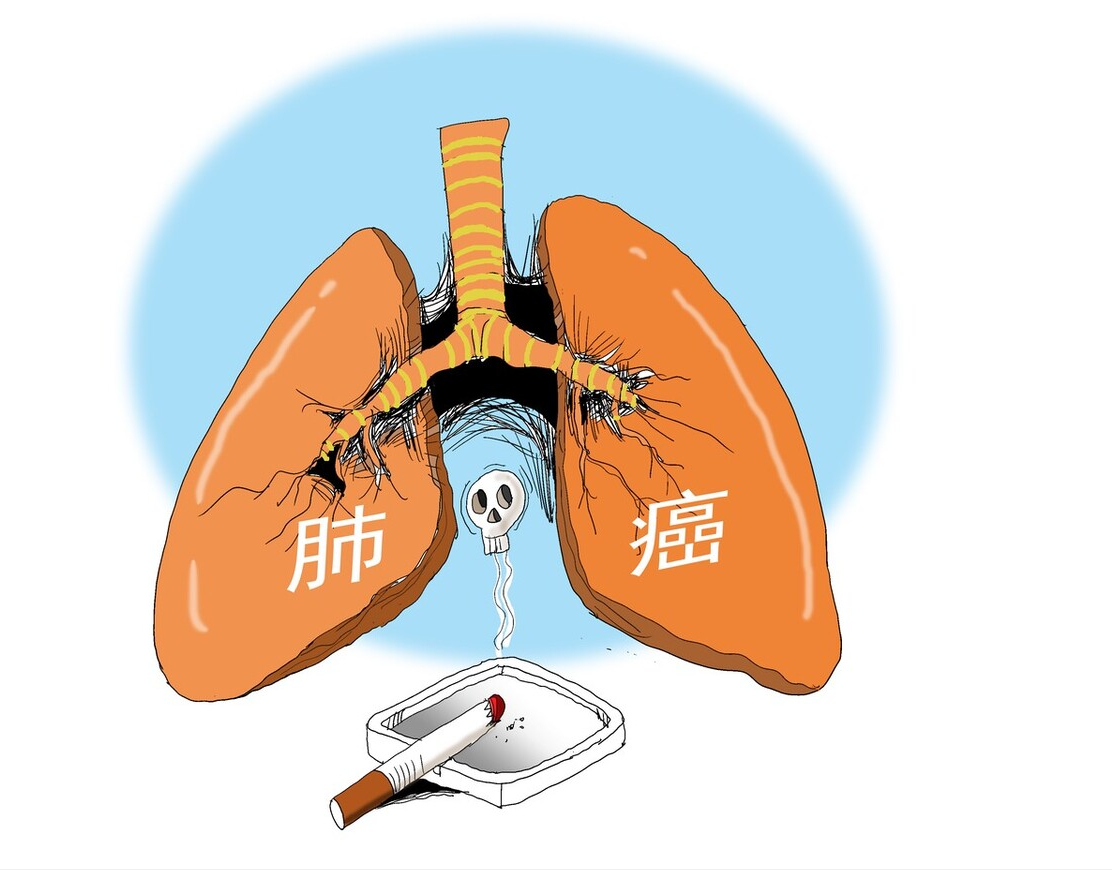癌症真的会遗传吗？医生提醒：这8种癌症受遗传影响极大
