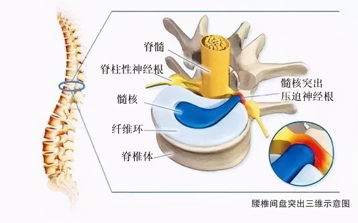腰部的基本生理结构及作用!