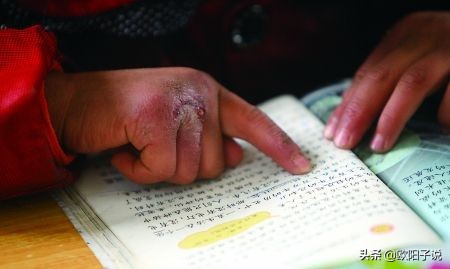 南方冻脚，教你一招让你的脚在整个冬天都是热的