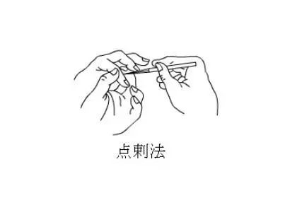 神奇的刺血疗法系列之少泽放血