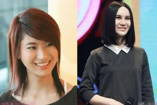 娱乐圈10位被整容毁掉的女星，有人脸僵如石，有的命丧手术台