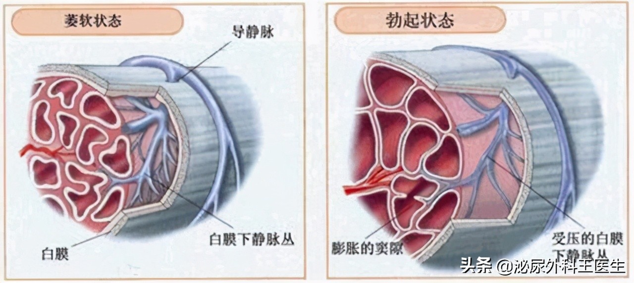男性ED选择高剂量西地那非好，还是低剂量他达拉非好，听3点建议