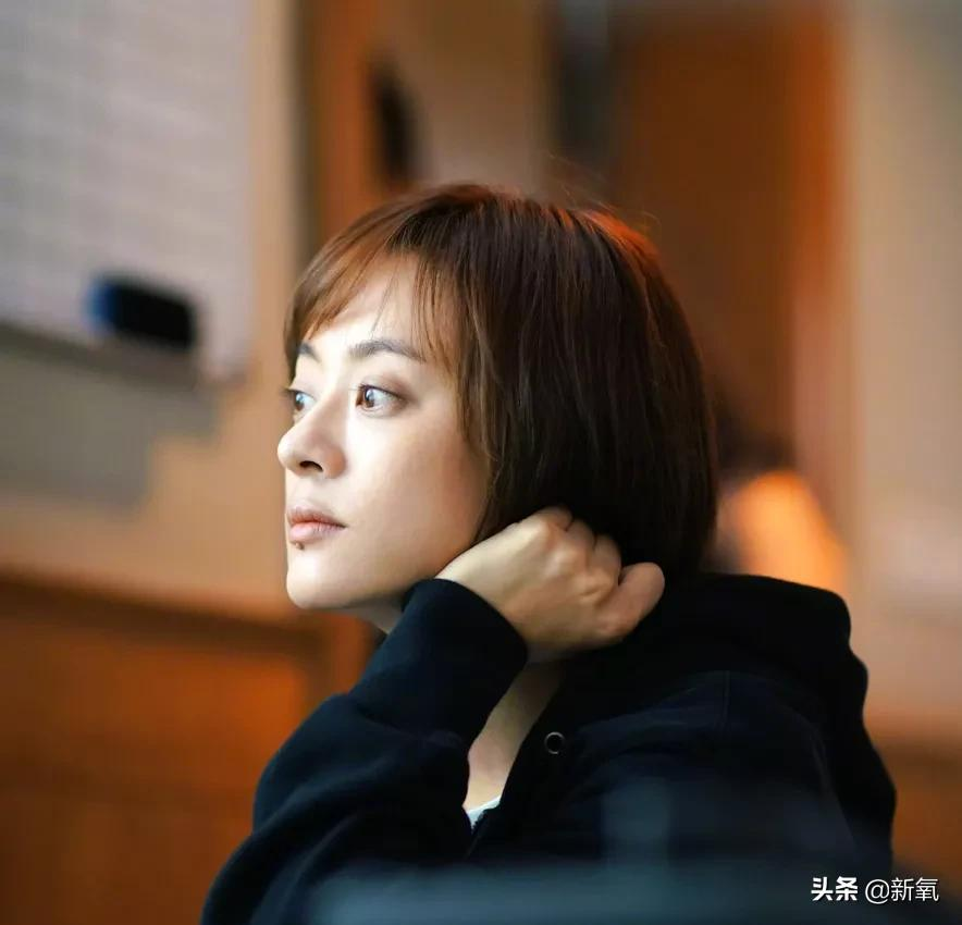 姐妹,双眼皮再好,咱也别硬割啊