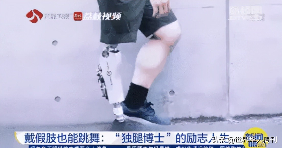 那个成了残疾人的男孩，10年后读博士给自己造了一条腿