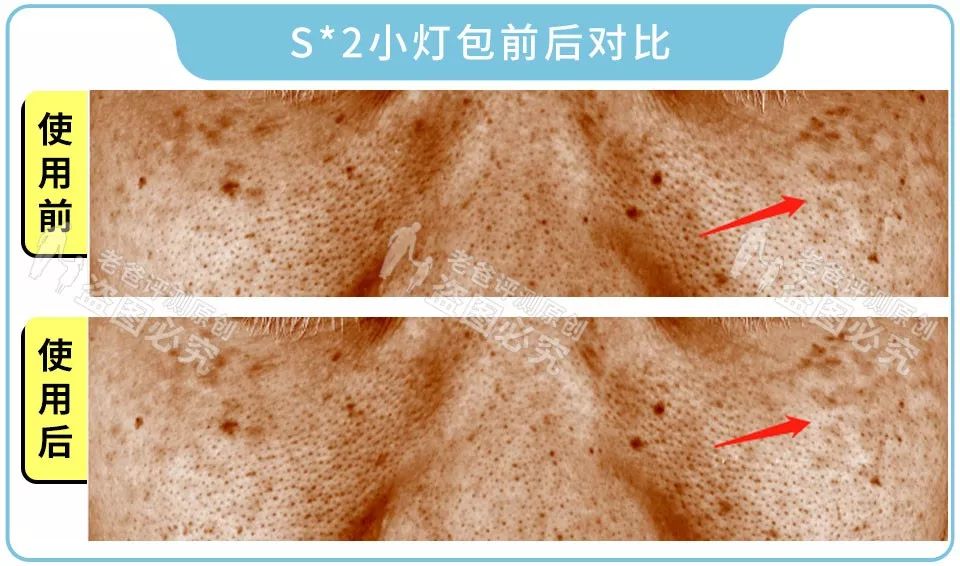 這些美白精華你一定用過，從幾十塊到上千塊，我們評測了13款發(fā)現(xiàn)