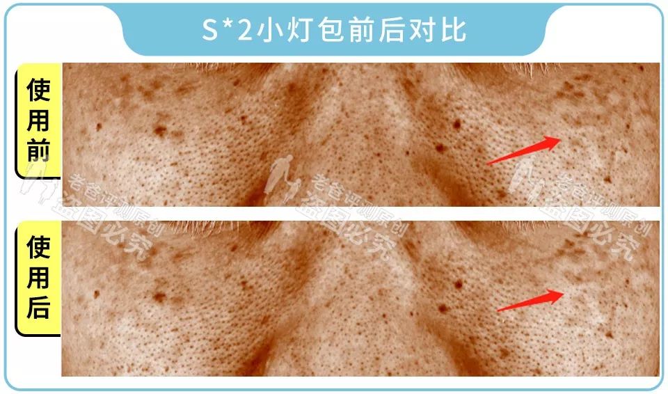 这些美白精华你一定用过，从几十块到上千块，我们评测了13款发现