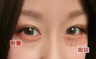 脸上有这3种卧蚕的女人,颜值一般都很高,检查下看看你有没有?