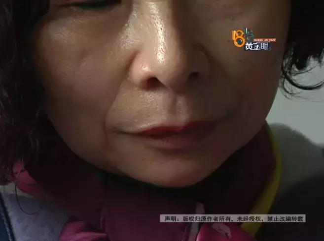 明明去买电饭锅,结果被老板娘带去工作室“祛皱”,花了1万多