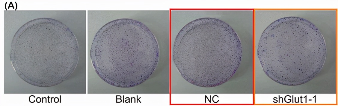 华北理工大学附属医院发表的SCI因图片疑似与他人文章重复遭质疑