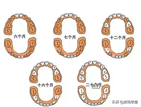 一千VS六万,治好孩子的满口坏牙到底要花多少钱?