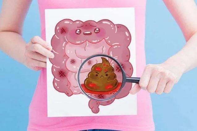 大便次数增多,28岁姑娘确诊癌症晚期!医生:有一种大便别忽视