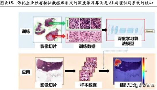 宫颈癌早筛专题报告：细胞学检测 AI与HPV检测是未来趋势