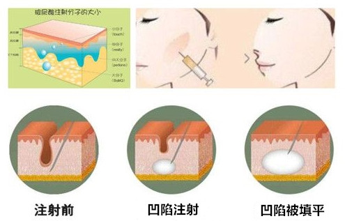 女人怎样保养脸部皮肤不老 面部年轻化的最好方法