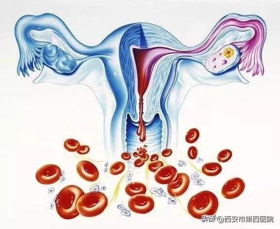 宫颈小疙瘩是什么原因引起的？