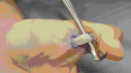 腱鞘炎如何形成的呢？肌腱又和腱鞘炎有什么关系？