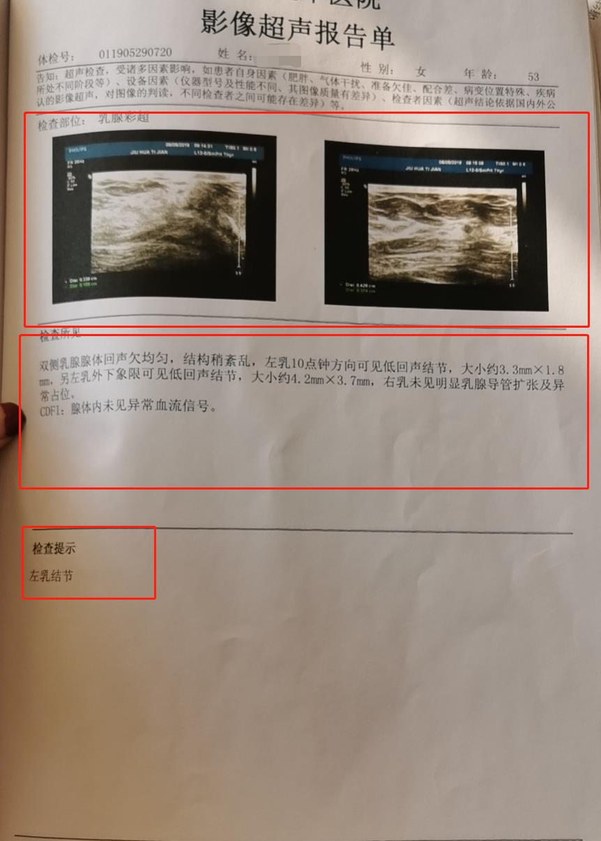 看不懂乳腺彩超报告单？别慌，看完这篇文章，秒懂