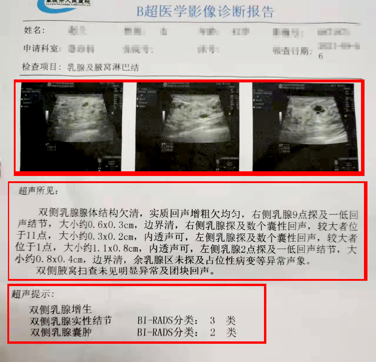乳腺彩超报告，没有这几点就不必过于忧心