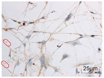 海南医学院第一附属医院发表的SCI因图片疑似重复被质疑