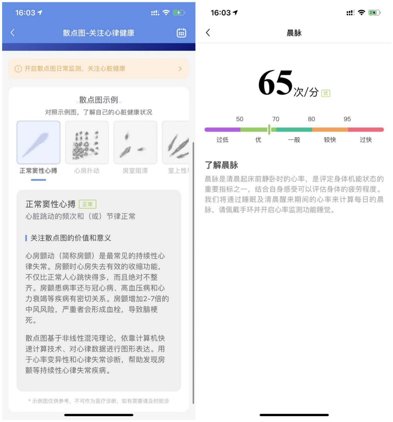 医学认可的测心率手表（性价比最高的医疗级健康手表）