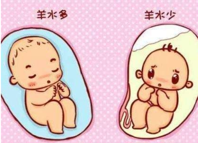 1,孕妈身体气色好孕妇的面部气色红不红润可以作为判断羊水浑浊与否的