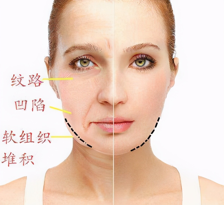 发腮？咬肌肥大？方脸女孩不削骨磨腮如何变美？如何拯救时髦感？