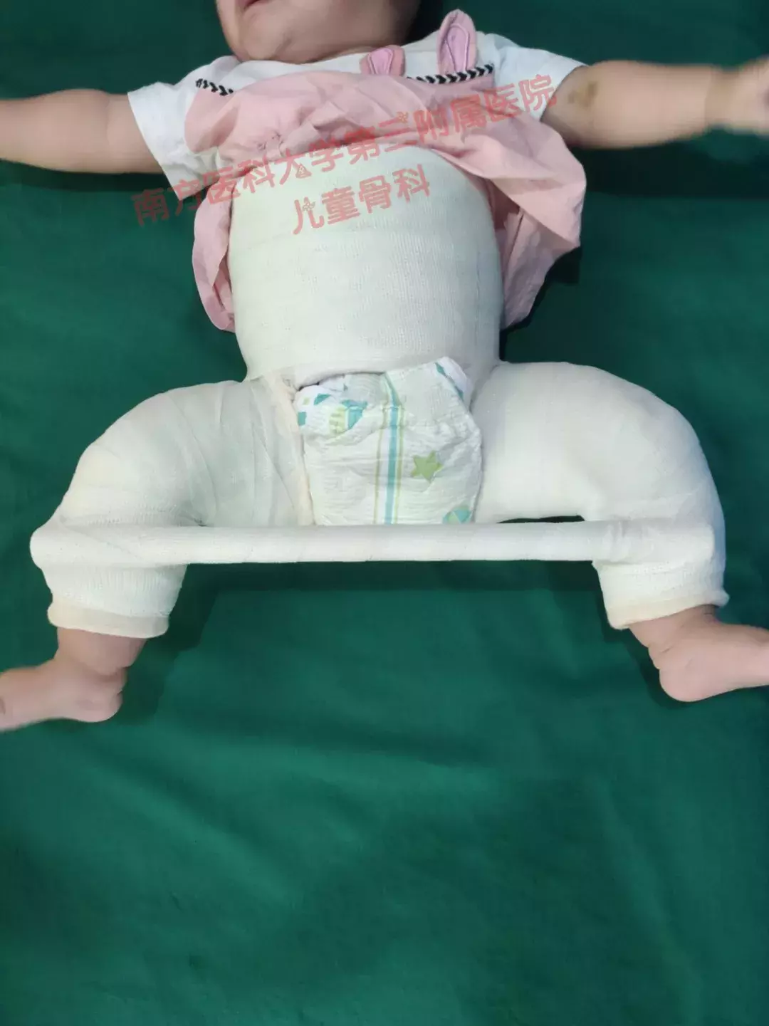 婴儿睡的脸大一边脸小（宝宝身体左右不对称怎么办）-幼儿百科-魔术铺