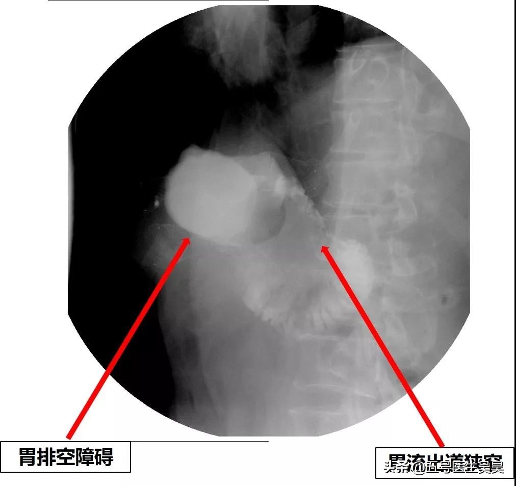 消化系统出了问题，我们都可能会做哪些检查？因病制宜才能诊断好