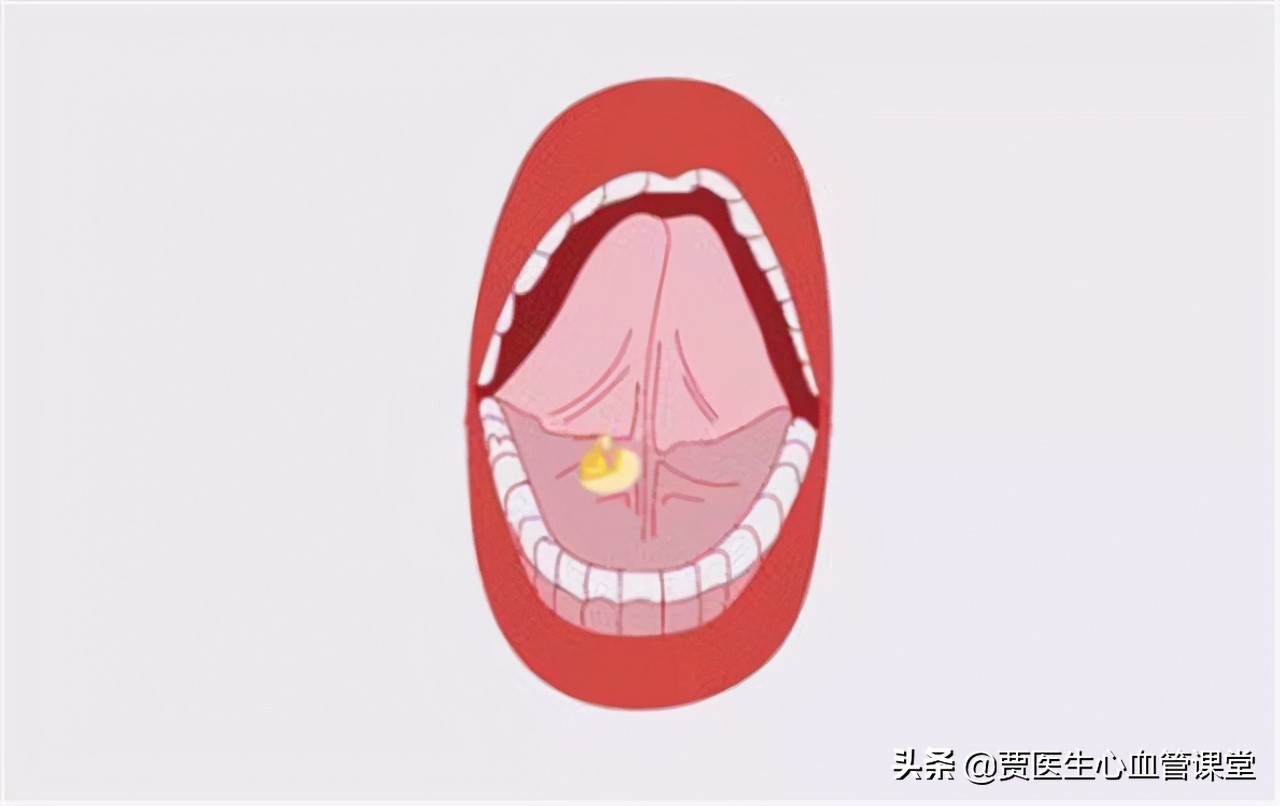 速效救心丸，你会正确使用吗？