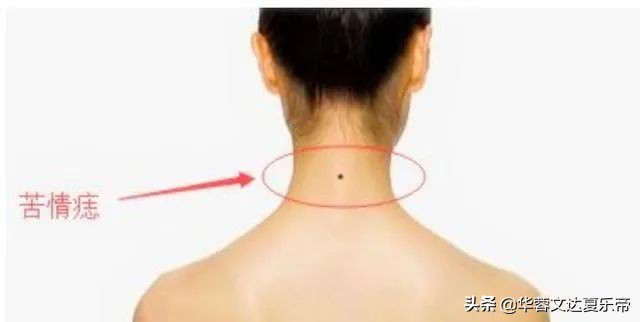 为什么很多人的脖子后面都有一颗痣？今天，我们来告诉各位答案