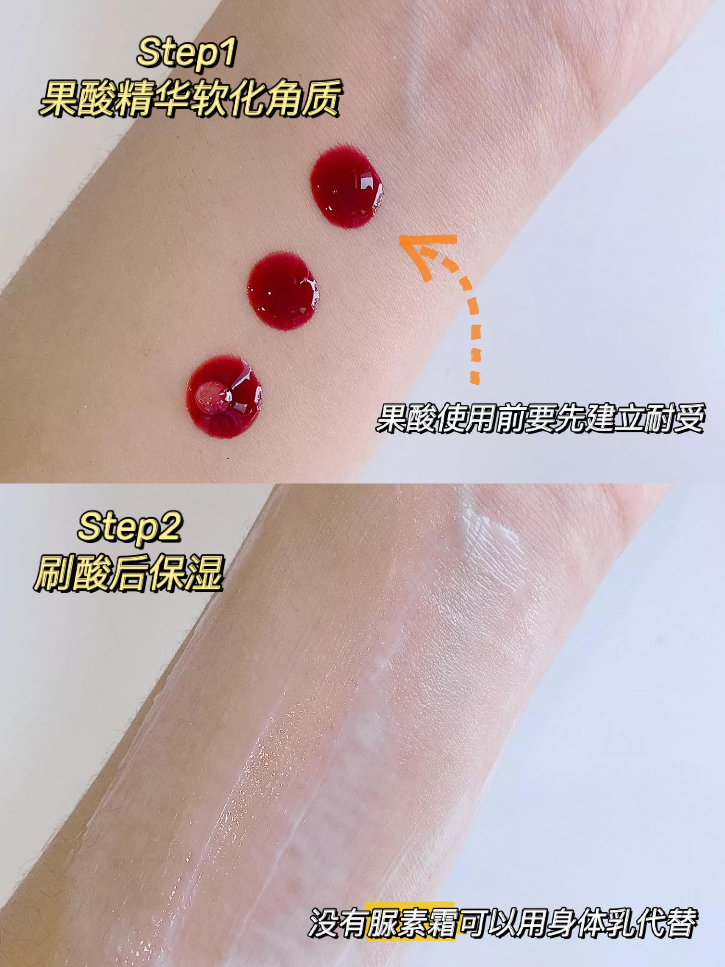 果酸美白真的有用吗（告诉你正确的果酸变白做法）