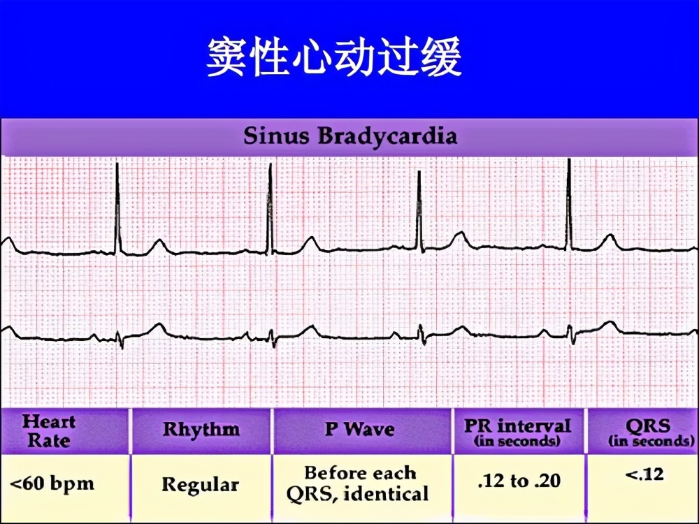 为什么足球比赛会突然晕倒(突发！欧洲杯丹麦球员突然晕厥抢救！医生说：可能是这几种疾病)