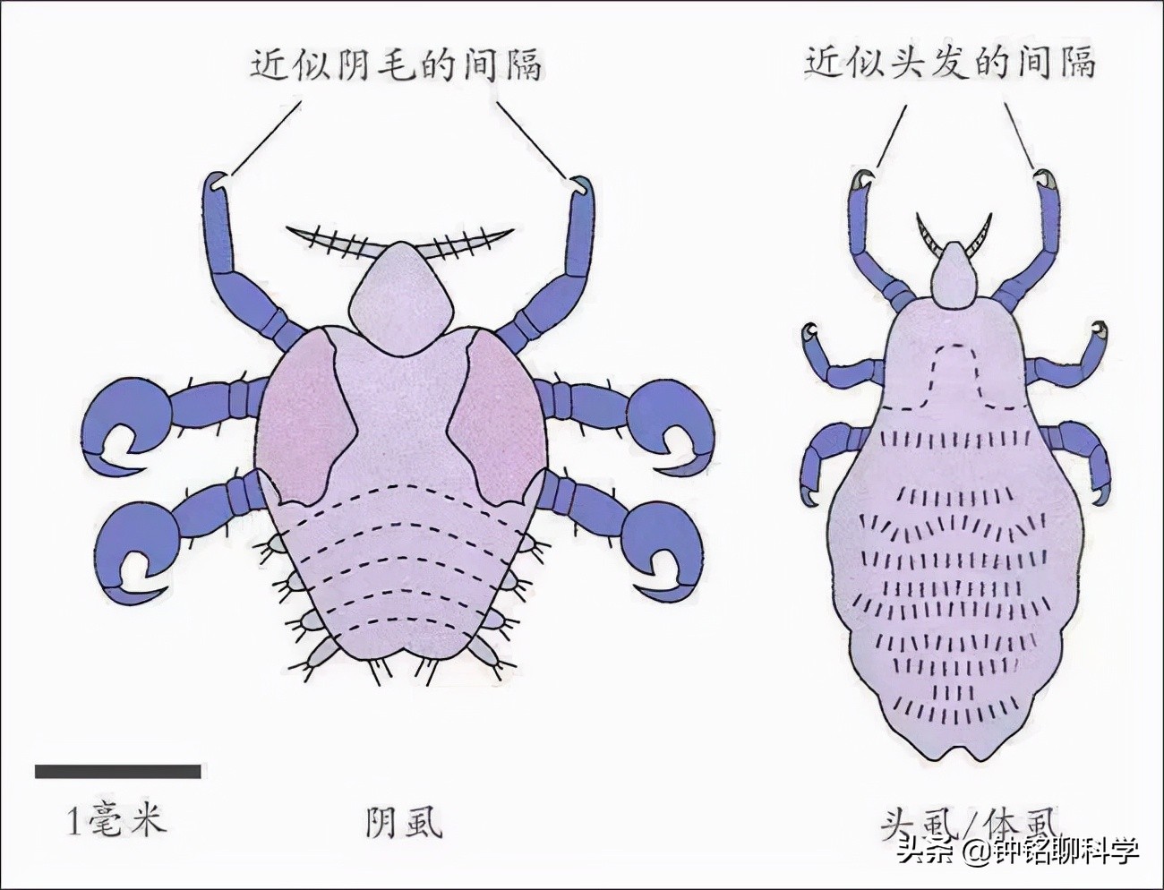 同人类共演化，解开人类“褪毛之谜”的虱子，现如今怎么消失了？