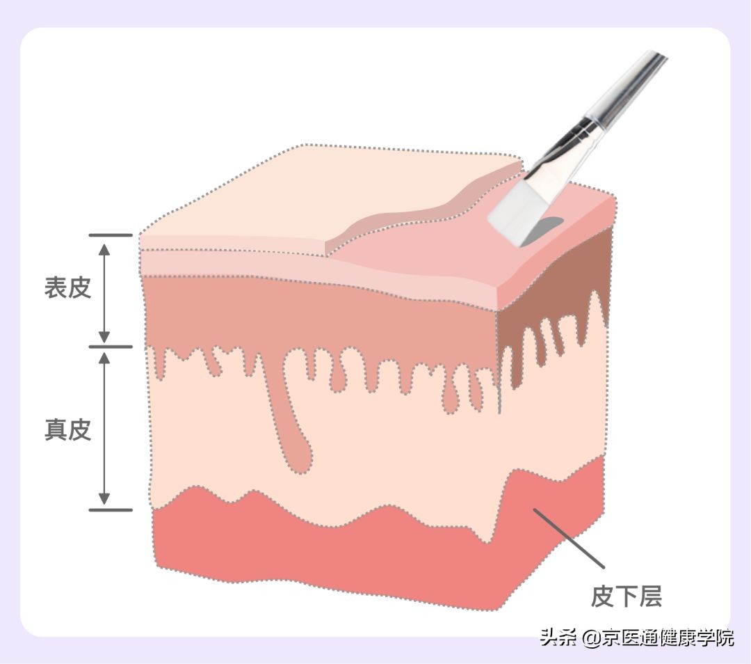 皮秒拿走的是「斑点」，还是你的不自信？