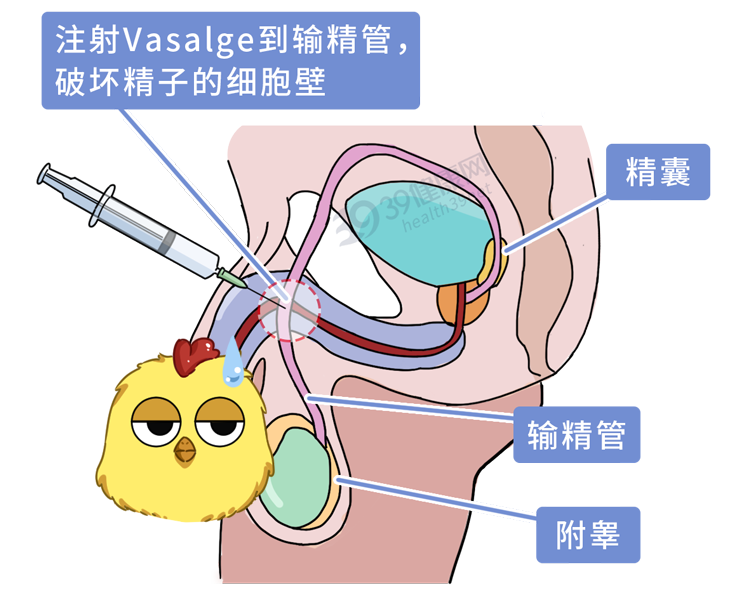 男性避孕又有新花样：一次注射，长久有效，不伤身副作用小