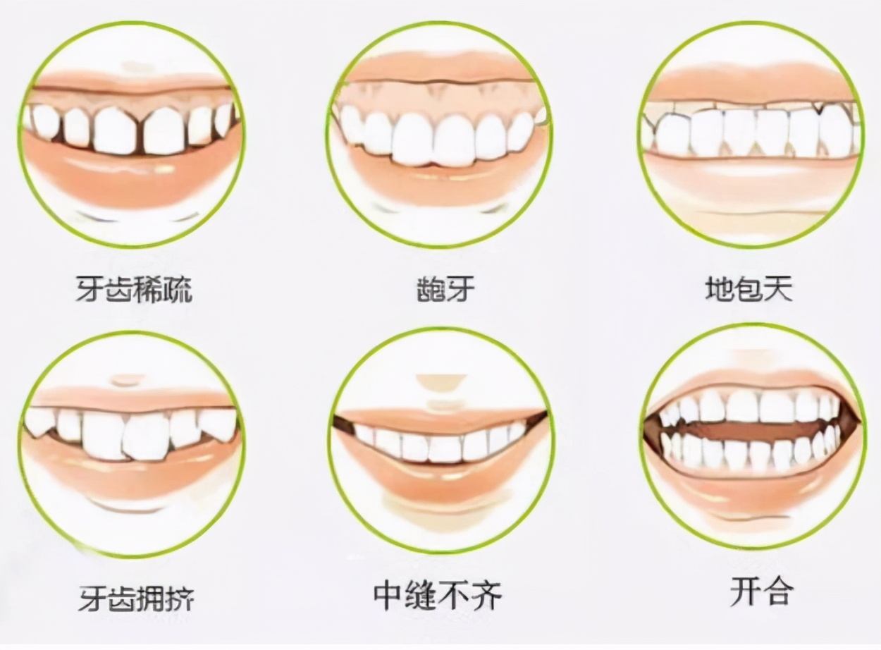 揭秘牙齿矫正“黑幕”！价格差别这么大，到底是怎么回事？