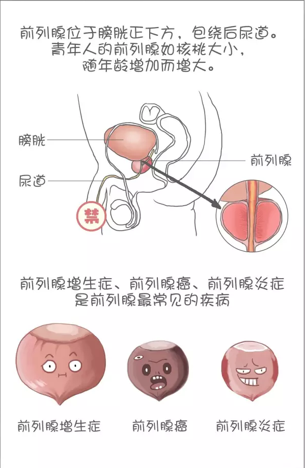 听说药物进不去前列腺，是不是药物治不了前列腺炎？