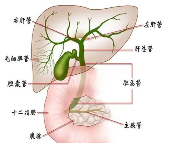 肝内胆管结石严重吗（肝内胆管结石怎么引起的）