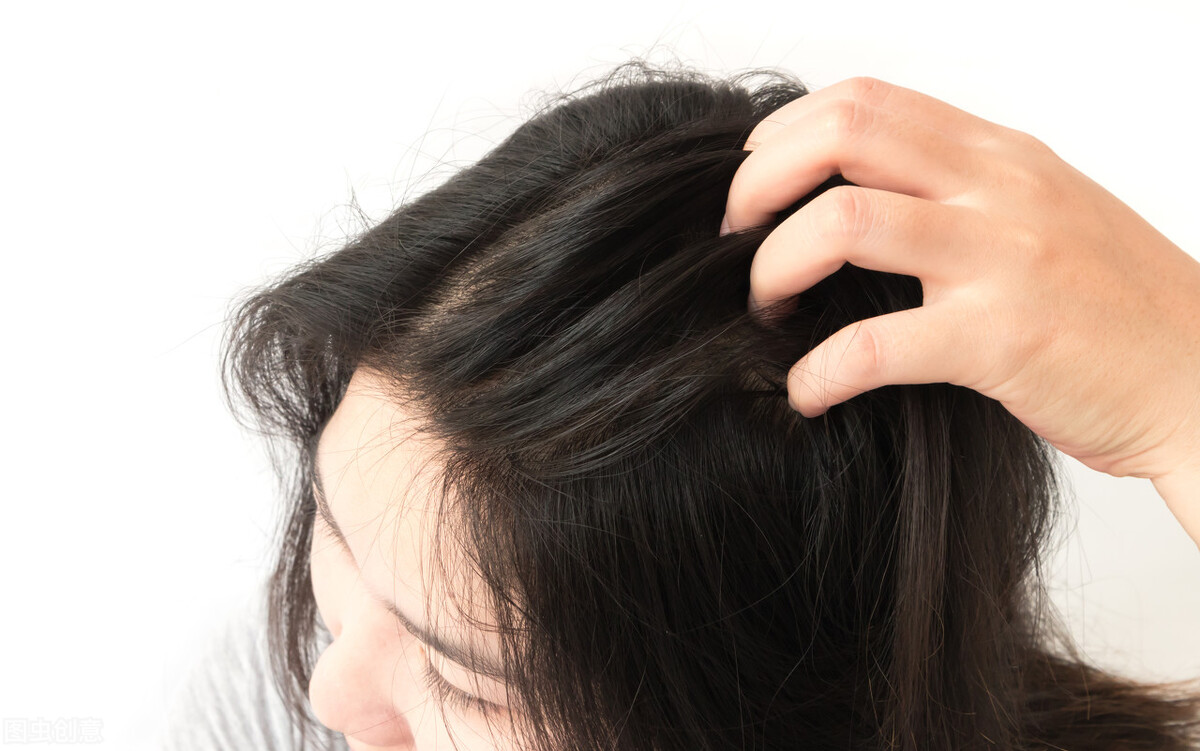 脂溢性皮炎想要断根，可以怎么治？这个抑菌方案或能奏效
