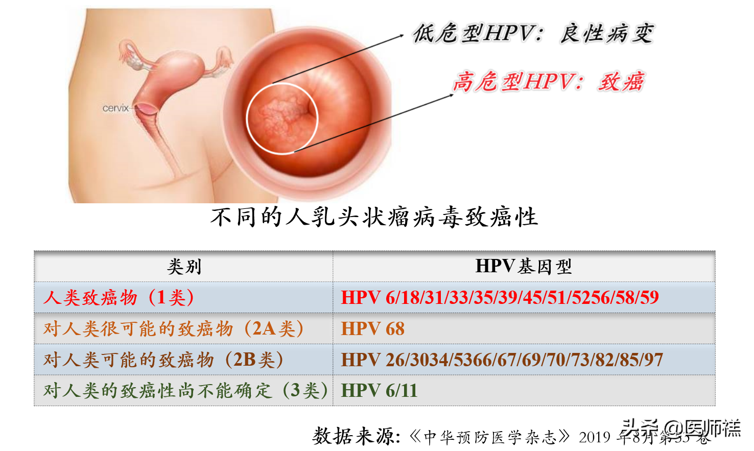 HPV疫苗一定要选九价？少花钱少排队二价疫苗比九价更值得