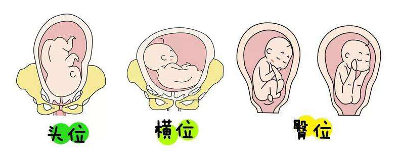 多少周定胎位最合适(胎儿在怀孕几个月胎位就固定了) 