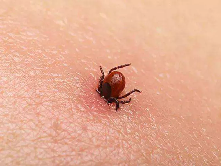 蜱虫钻进人身体图片(致命蜱虫再现) - 赤虎壹号