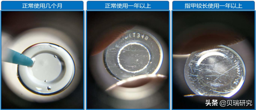 眼科不止连锁医院一个赛道，“魔幻暴利”的OK镜同样坡长雪厚